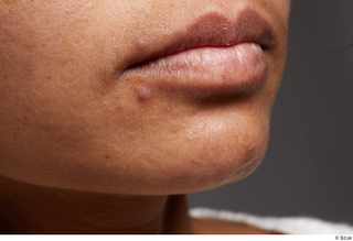 HD Face Skin Martha Hutahaean cheek chin face lips mouth…